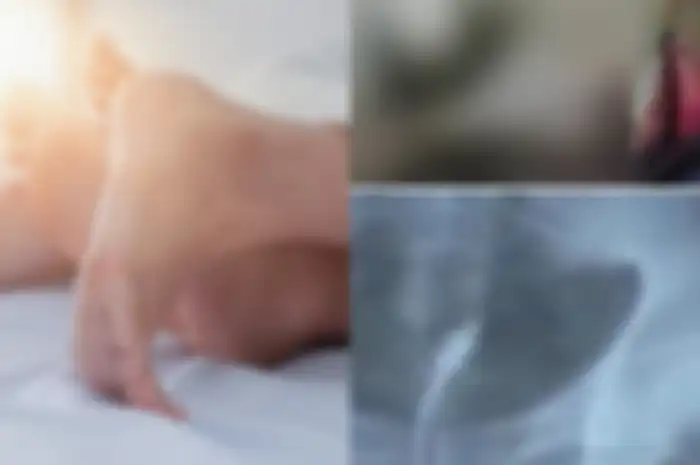 Pria ini jejeritan usai berhubungan intim setelah lihat pemandangan mengerikan di organ intim istrinya