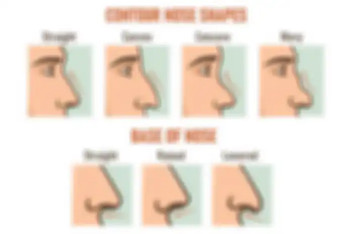Ilustrasi bentuk hidung.
