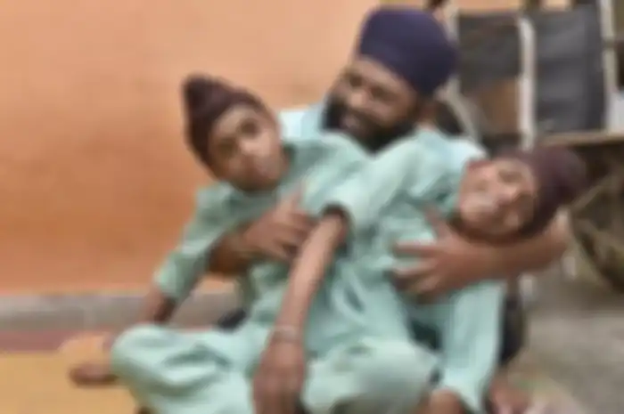 Saudara kembar siam dari India Sohna Singh dan Mohna Singh