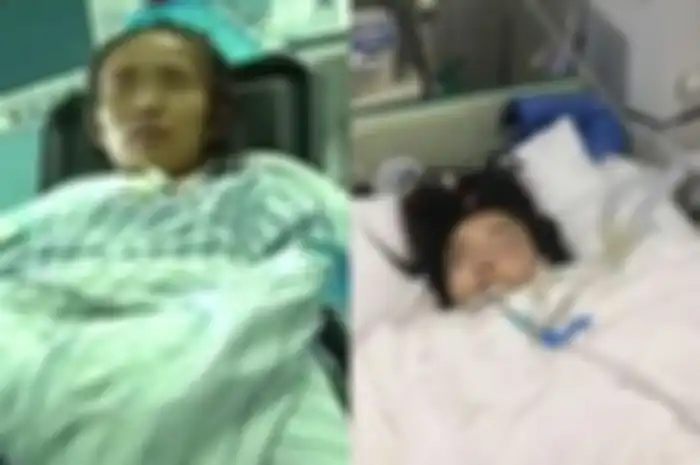 Wanita ini terpaksa kehilangan satu kakinya