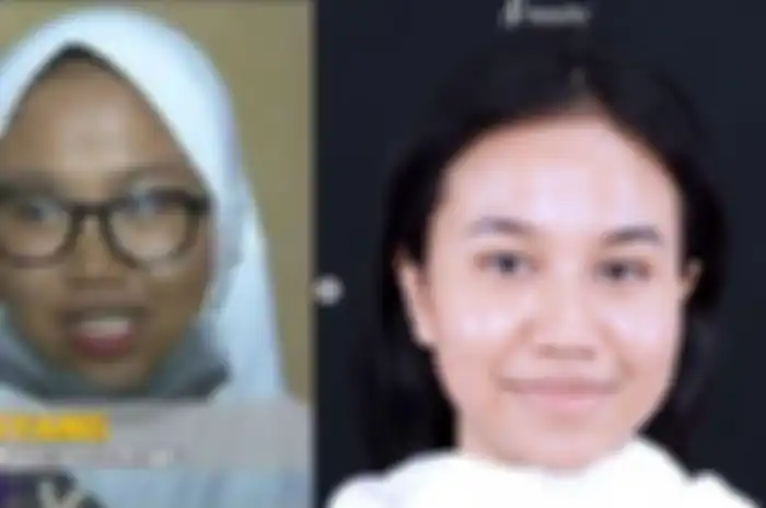 Wajah Mayang selama menjalani perawatan
