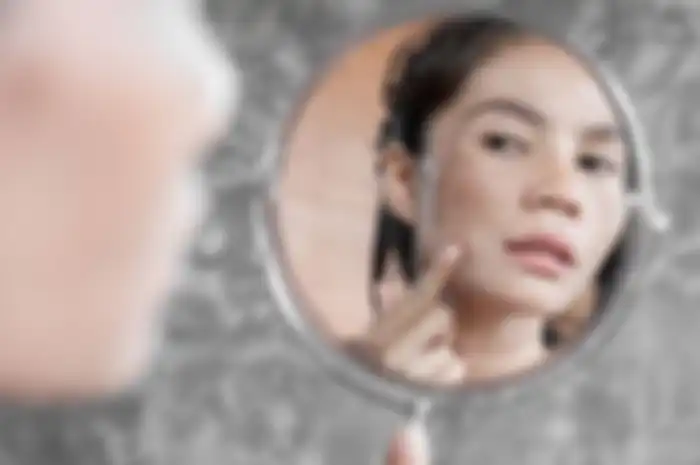 Cara Menghilangkan flek hitam