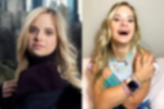 Sofia Jirau mencetak sejarah menjadi model Victoria's Secret pertama dengan Down syndrome atau sindrom Down.