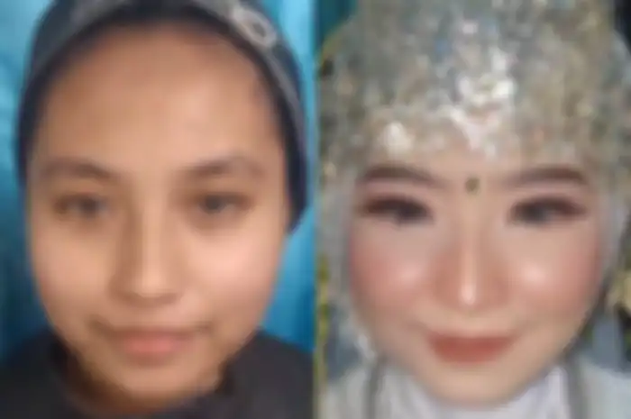 Before dan After wajah baby sitter anak Mawar AFI yang diduga selingkuh dengan Steno Ricardo
