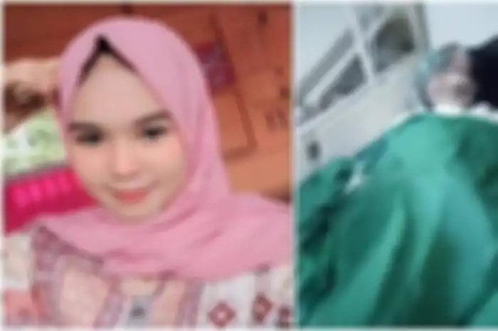 Diana Ningsih dibakar hidup-hidup oleh sang kekasih lantaran tak terima diputus.