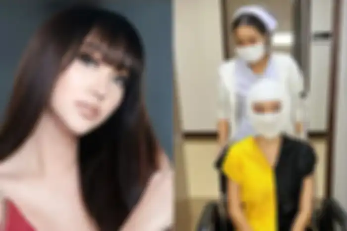 Lucinta Luna diduga lakukan operasi plastik lagi.