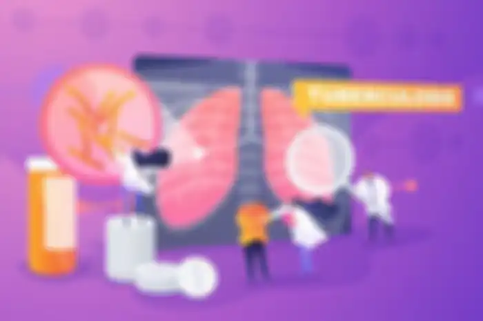 Ilustrasi tuberkulosis (TBC)