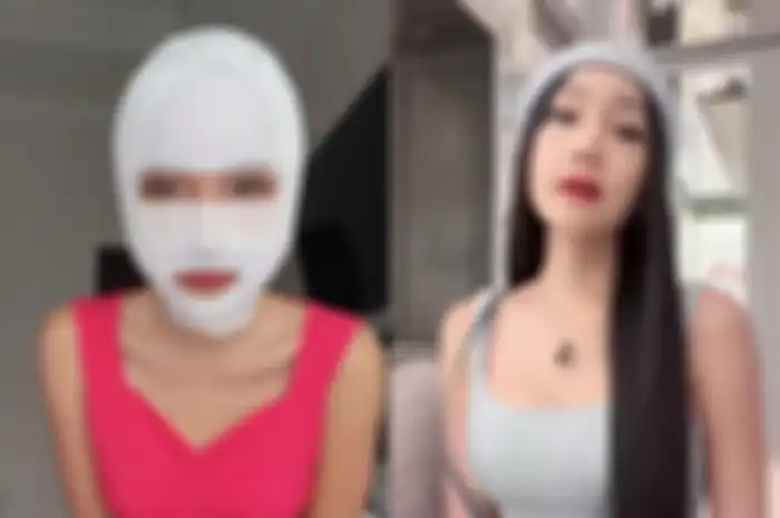  Lucinta Luna setelah jalani operasi plastik.