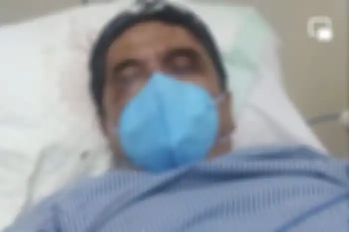 Pengeroyok Ade Armando sudah ditetapkan sebagai tersangka. Pelaku coba kelabui polisi dengan cara begini. Foto tampangnya beredar.