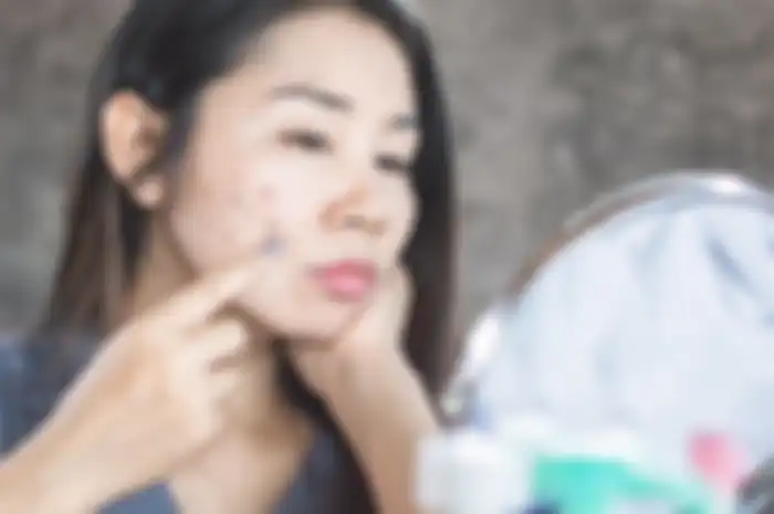 Cara menghilangkan flek hitam 