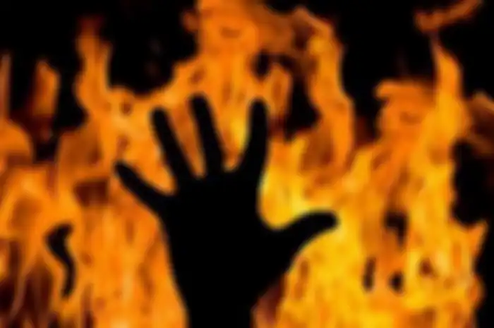 Ilustrasi orang dibakar.