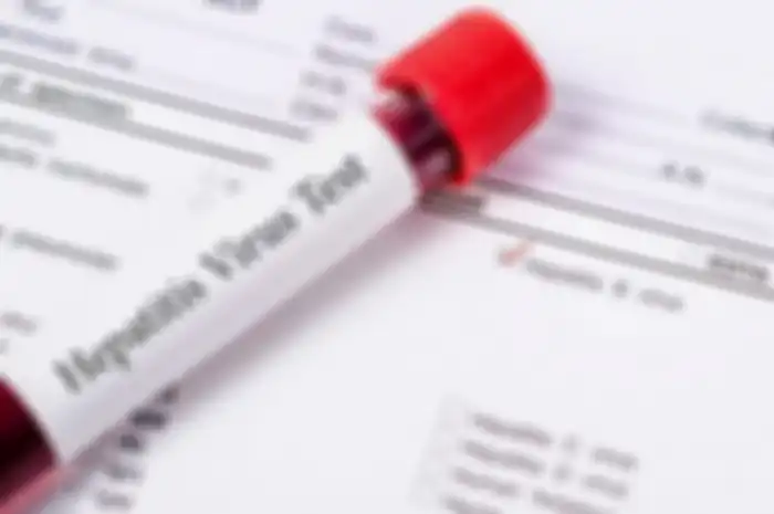 Hasil studi CDC kasus hepatitis akut misterius.