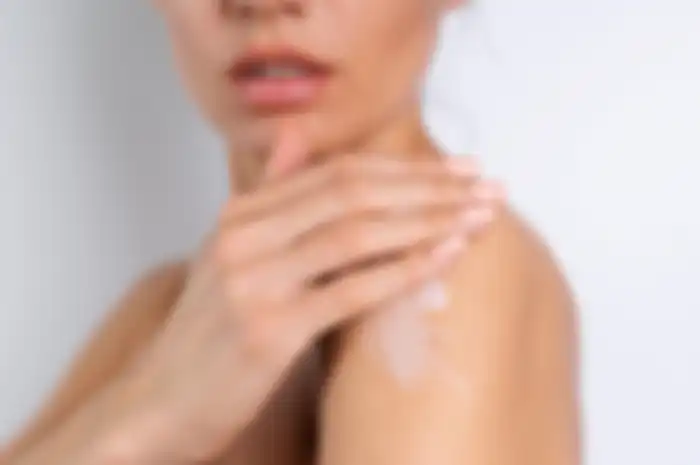 cara mengatasi kulit belang