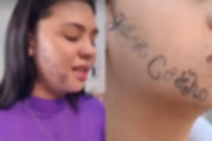 Tayane Caldas, wanita yang ditato paksa oleh mantan kekasihnya