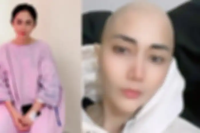 Aida Saskia berjuang melawan kanker