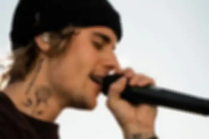 Justin Bieber idap sindrom Ramsay Hunt