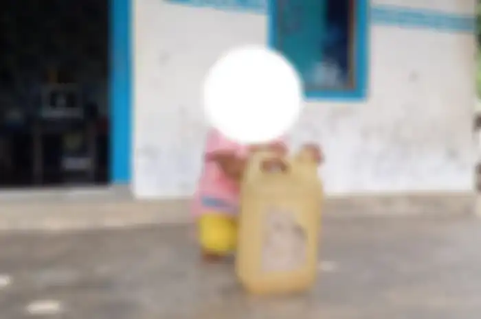Seorang balita kecanduan cium aroma pertalite.