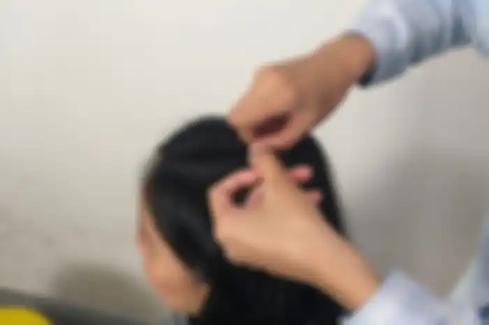 Tips Hidup Bebas Kutu Rambut