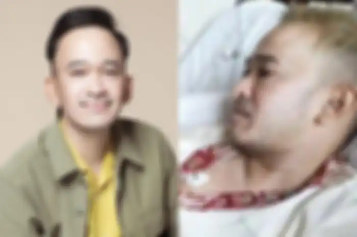 Kondisi Ruben Onsu yang alami sakit di otak
