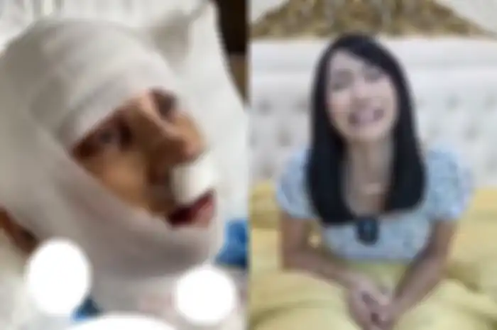 Lucinta Luna operasi jakun demi hilangkan suara khodam.
