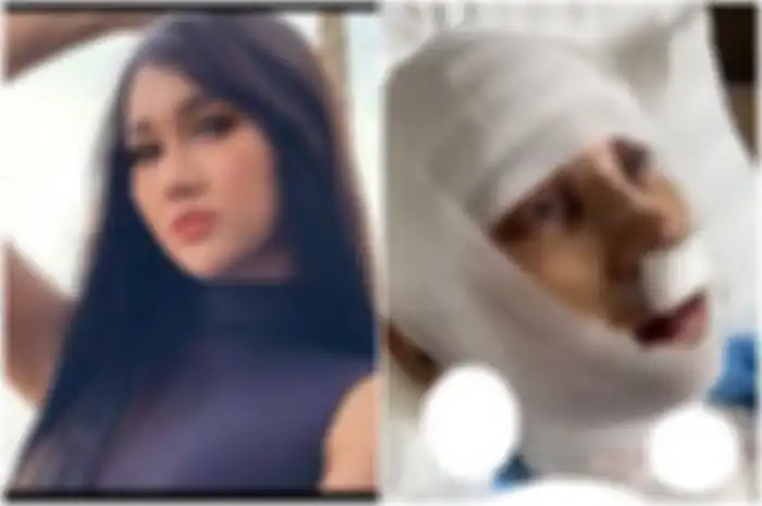 Lucinta Luna jalani operasi demi punya suara perempuan.