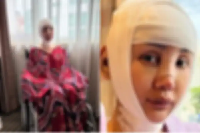Lucinta Luna masih belum puas dengan dua kali operasi