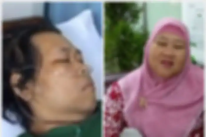 RIni S Bon Bon meninggal dunia karena diabetes melitus