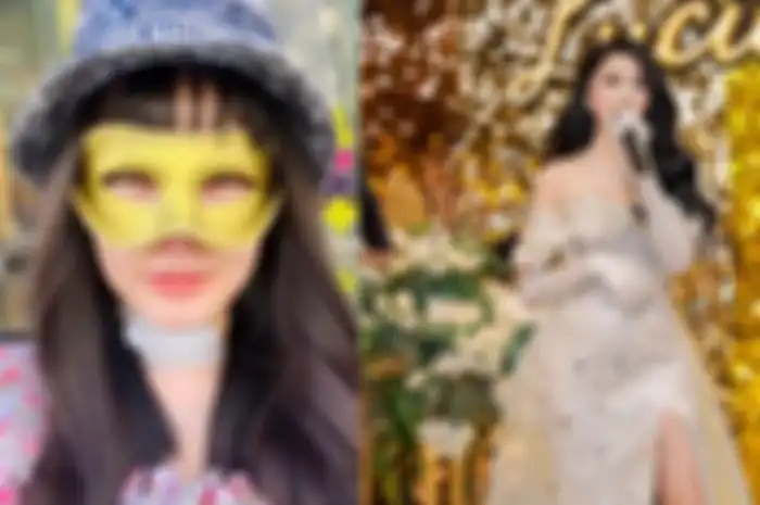 Lucinta Luna akui kembali lakukan operasi plastik. 