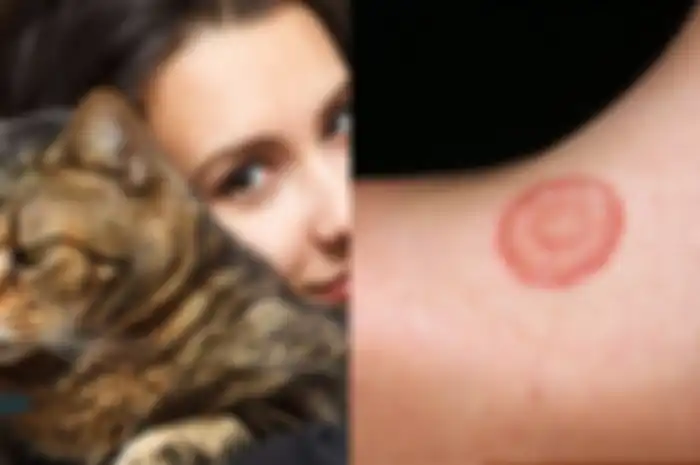 Apa itu ringworm? Kelainan kulit atau kurap yang terjadi karena kontak dengan kucing yang terinfeksi.
