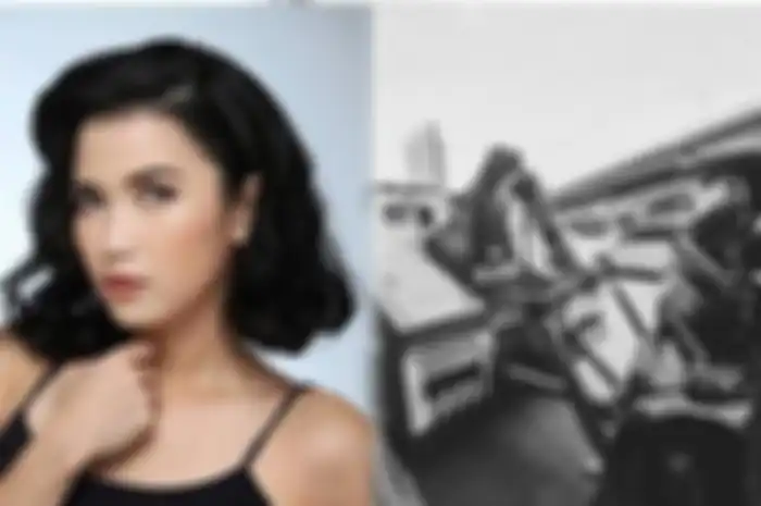 Artis Dinda Kanya Dewi baru saja tertimpa musibah, ia menjadi korban tabrak lari supir truk.