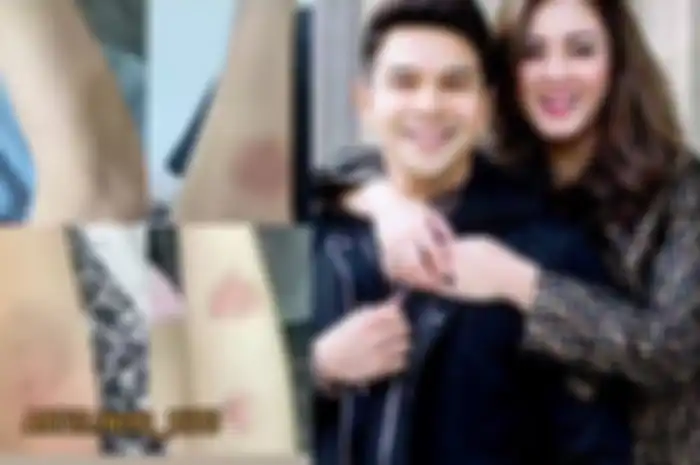 Kolase foto Dhena Devanka dan Jonathan Frizzy.