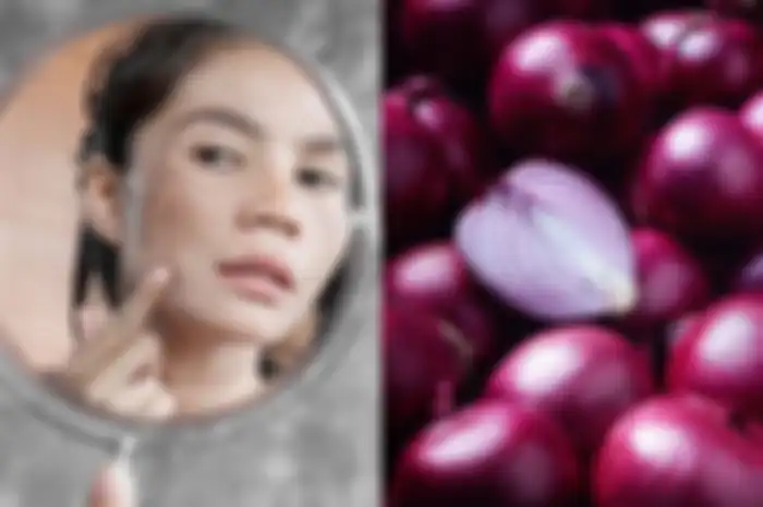 Anda bisa menggunakan bawang merah yang seperti ini untuk menghilangkan flek hitam dalam 10 menit