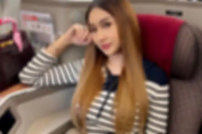 Lucinta Luna lakukan operasi plastik supaya mirip Jisoo Blackpink