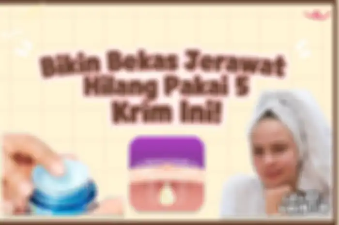 Bikin Bekas Jerawat Hilang Pakai 5 Krim Ini!