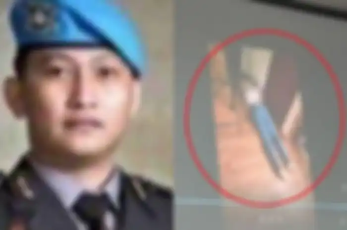 Kondisi jasad Brigadir J yang diambil 1 jam setelah ditembak terungkap