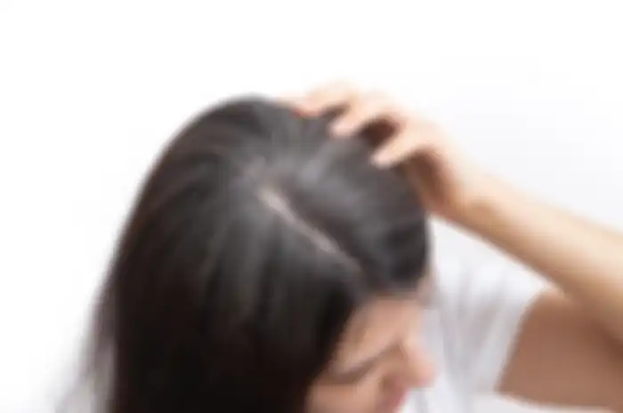 Uban di rambut bisa hilang dengan menggunakan 1 sayuran ini.
