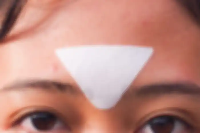Jerawat di Antara Alis