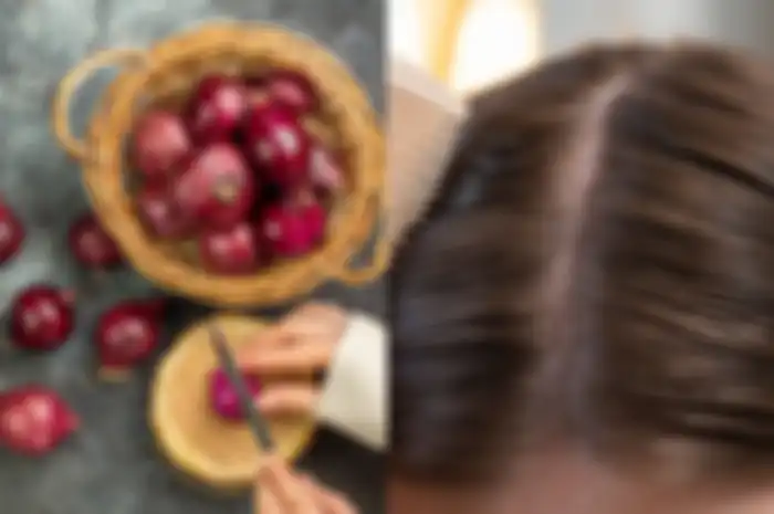 bawang merah jadi salah satu bahan alami untuk menghilangkan kutu rambut 
