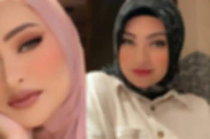 Wajah mulus tanpa pori Nathalie Holscher tuai sorotan, terungkap fakta yang sebenarnya
