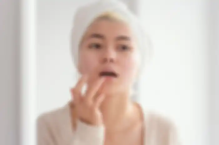 Tips hidup sehat merawat bibir agar tidak kering dan mengganggu penampilan.