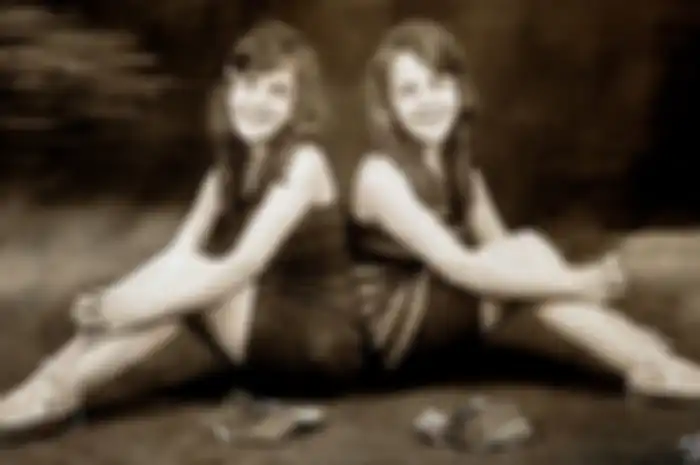 Si kembar Daisy dan Violet Hilton