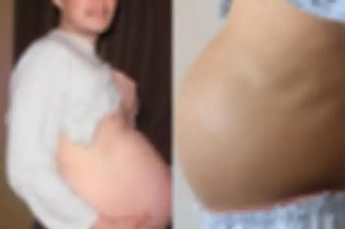 Perut pria ini membuncit bak wanita hamil
