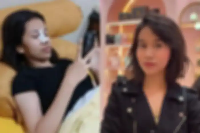 Mayang Lucyana Fitri dikabarkan lakukan operasi hidung.