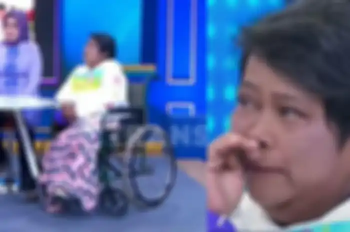 Suti Karno amputasi kaki