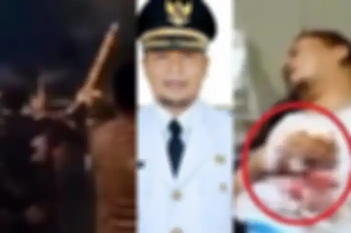 Luka serius dialami oleh Wakil Bupati Kabupaten Kaur, Provinsi Bengkulu, Herlian Muchrim saat sedang merayakan malam pergantian tahun 2022 ke 2023