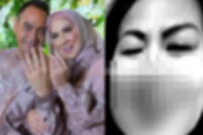 Ferry Irawan ternyata lakukan ini hingga bikin hidung Venna Melinda banjir darah