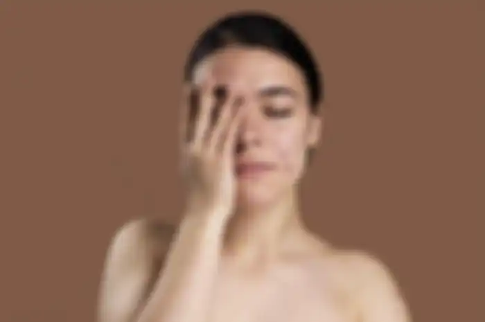 Ada tips hidup menghilangkan jerawat dengan hanya dengan mengikuti kebiasaan harian yang lebih sehat, apa saja?