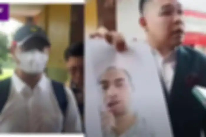 Ferry Irawan jalani pemeriksaan bawa bukti dokumen foto bibir terluka akibat cakaran