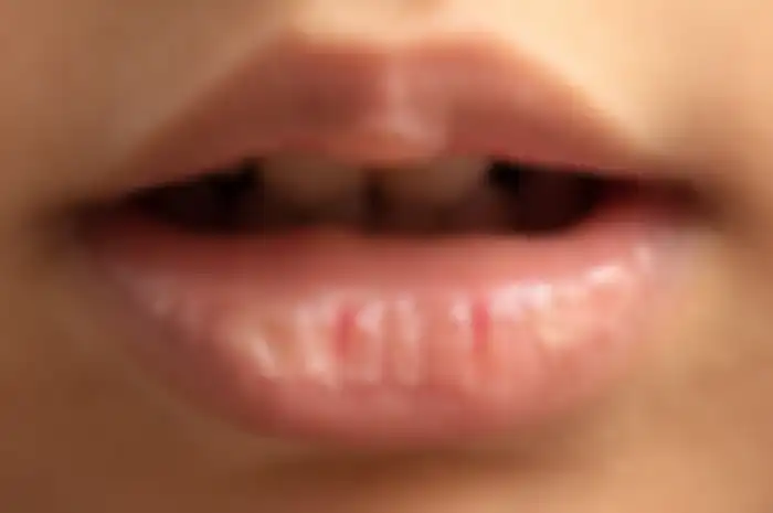 bibir kering