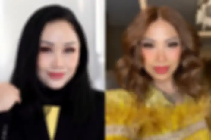 Titi DJ setelah jalani operasi plastik (kiri) dan sebelum operasi (kanan)